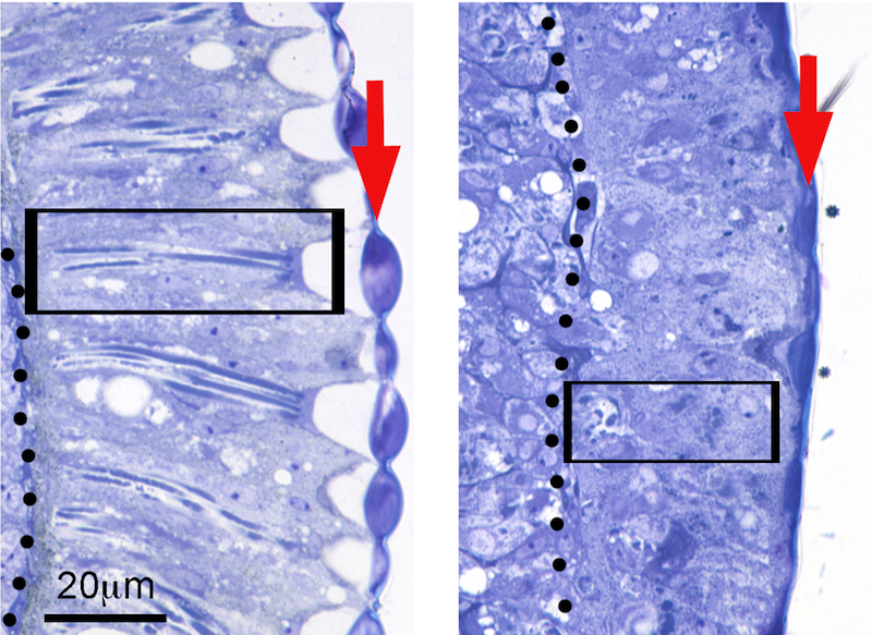 Flies expressing the toxic amyloid-β42 (Aβ42) peptide found in the Alzheimer’s disease brain disrupt the organization of the retina, resulting in short photoreceptors (box) and fused lenses (arrow)