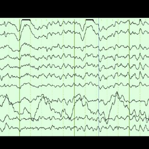 EEG reading